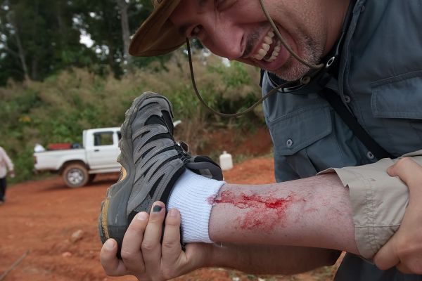 Richard Hughes leech wound