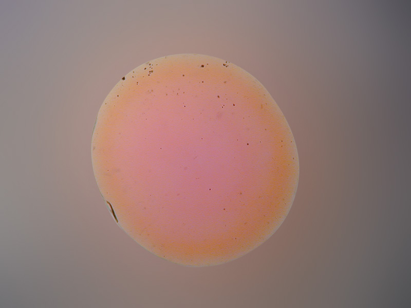 Orange rim surrounding a pink core in a surface-diffusion treated orange sapphire from Madagascar. The color rim is visible when the gem is immersed in di-iodomethane and is evidence of a treatment applied after cutting. Note that recutting such stones will produce a loss of the orange color.