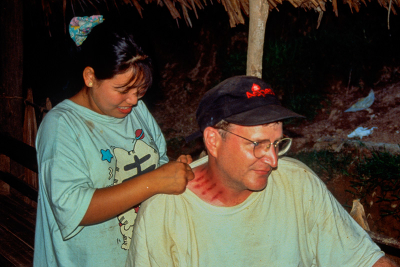 Bug spray Malaria is a major concern for anyone living or traveling in the jade-mines area. In this land of animism, the preferred local solution is embossing the skin by pinching it with a coin. Here Richard Hughes has the treatment applied. The efficacy of this bug protection was made crystal clear in Mogaung, where Hughes and French gem dealer, Olivier Galibert slept side-by-side in the same bed. Come morning, Galibert's body was covered with bedbug bites, while Hughes was untouched.