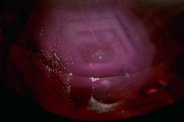 Mong Hsu, Mong Hsu ruby, flux healing, glass filling, Burma ruby, heat treatment, gemology